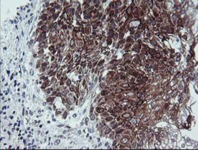 Immunohistochemistry: Calpastatin Antibody (OTI1E7) - Azide and BSA Free [NBP2-70338]