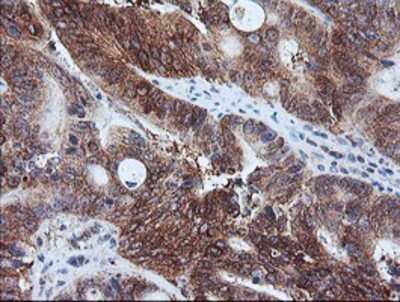 Immunohistochemistry: Calpastatin Antibody (OTI1E7) - Azide and BSA Free [NBP2-70338]