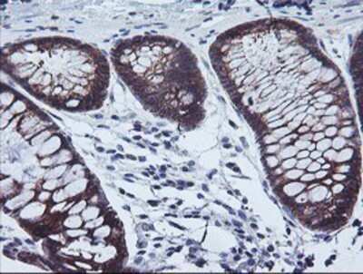 Immunohistochemistry: Calpastatin Antibody (OTI1E7) - Azide and BSA Free [NBP2-70338]