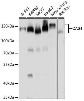 Western Blot: Calpastatin AntibodyBSA Free [NBP2-92941]