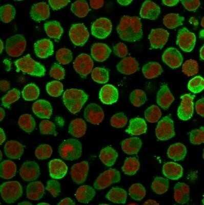 Immunocytochemistry/ Immunofluorescence: Calponin 1 Antibody (CALP) - Azide and BSA Free [NBP2-47712]