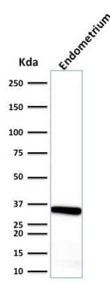 Western Blot: Calponin 1 Antibody (CALP)Azide and BSA Free [NBP2-47712]