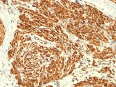 Immunohistochemistry-Paraffin: Calponin 1 Antibody (CALP) [NBP2-44479]