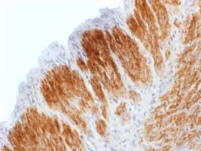 Immunohistochemistry-Paraffin: Calponin 1 Antibody (CNN1/1408R) [NBP2-53233]