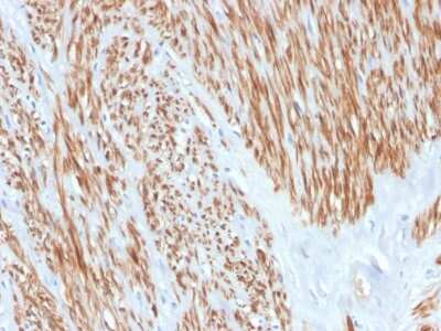 Immunohistochemistry-Paraffin: Calponin 1 Antibody (CNN1/4227R) [NBP3-07589]