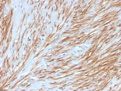 Immunohistochemistry-Paraffin: Calponin 1 Antibody (CNN1/4227R) [NBP3-07589]