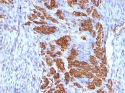 Immunohistochemistry-Paraffin: Calponin 1 Antibody (CNN1/832 + CALP) - Azide and BSA Free [NBP2-47758]