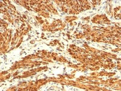 Immunohistochemistry-Paraffin: Calponin 1 Antibody (CNN1/832 + CALP) [NBP2-44482]
