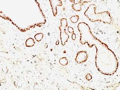 Immunohistochemistry-Paraffin: Calponin 1 Antibody (CNN1/832 + CALP) [NBP2-44482]