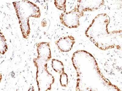 Immunohistochemistry-Paraffin: Calponin 1 Antibody (CNN1/832) - Azide and BSA Free [NBP2-47757]