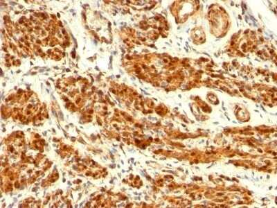 Immunohistochemistry-Paraffin: Calponin 1 Antibody (CNN1/832) - Azide and BSA Free [NBP2-47757]