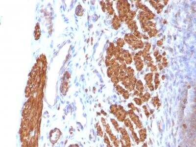 Immunohistochemistry-Paraffin: Calponin 1 Antibody (CNN1/832) - IHC-Prediluted [NBP2-48205]