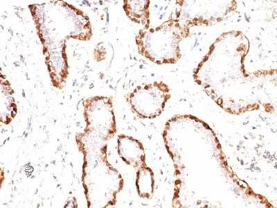 Immunohistochemistry-Paraffin: Calponin 1 Antibody (CNN1/832) [NBP2-44481]