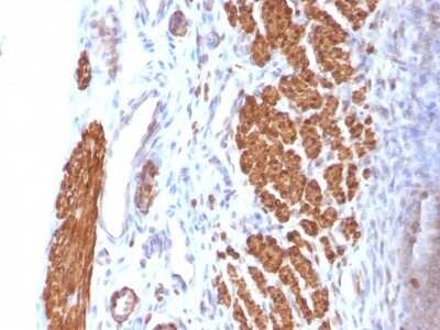 Immunohistochemistry-Paraffin: Calponin 1 Antibody (CNN1/832) [NBP2-44481]