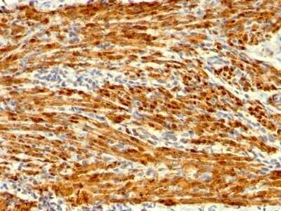 Immunohistochemistry-Paraffin: Calponin 1 Antibody (SPM169) - Azide and BSA Free [NBP2-47713]