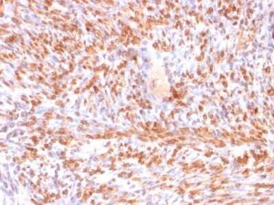Immunohistochemistry-Paraffin: Calponin 1 Antibody (rCNN1/832) - Azide and BSA Free [NBP2-54381]
