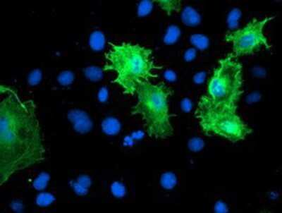 Immunocytochemistry/ Immunofluorescence: Calponin 2 Antibody (OTI2B5) [NBP2-01325]