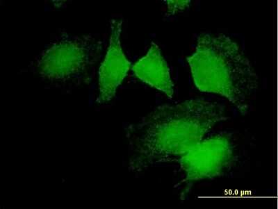 Immunocytochemistry/ Immunofluorescence: Calponin 2 Antibody [H00001265-B01P]