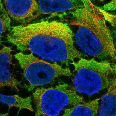 Immunocytochemistry/ Immunofluorescence: Calponin 2 Antibody [NBP2-13848]