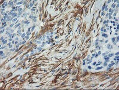 Immunohistochemistry: Calponin 2 Antibody (OTI2B5) - Azide and BSA Free [NBP2-70421]
