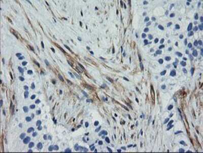 Immunohistochemistry: Calponin 2 Antibody (OTI2B5) - Azide and BSA Free [NBP2-70421]