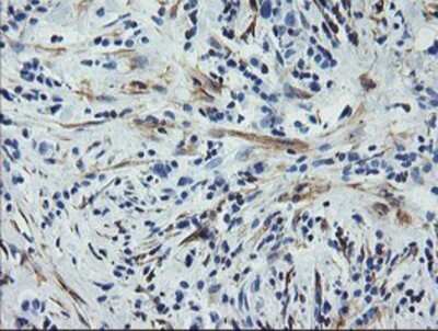 Immunohistochemistry: Calponin 2 Antibody (OTI2B5) - Azide and BSA Free [NBP2-70421]