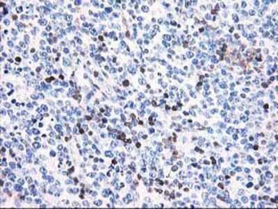 Immunohistochemistry: Calponin 2 Antibody (OTI2B5) - Azide and BSA Free [NBP2-70421]