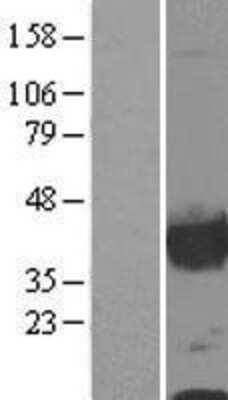 Western Blot: Calponin 1 Overexpression Lysate [NBL1-09314]