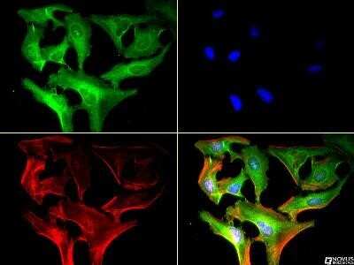 Immunocytochemistry/ Immunofluorescence: Calreticulin Antibody (1G6A7) - Azide and BSA Free [NBP2-80610]