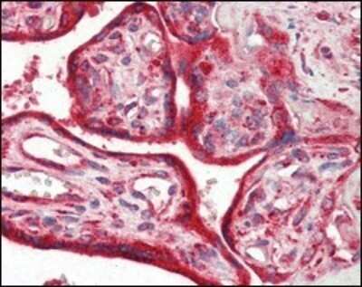 Immunohistochemistry-Paraffin: Calreticulin Antibody (1G6A7) - Azide and BSA Free [NBP2-80610]