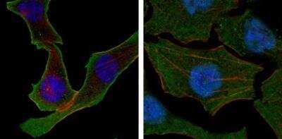 Immunocytochemistry/ Immunofluorescence: Calreticulin Antibody (1G6A7) - BSA Free [NBP1-47518]