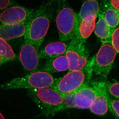 Immunocytochemistry/ Immunofluorescence: Calreticulin Antibody (6C6) [NBP2-50053]
