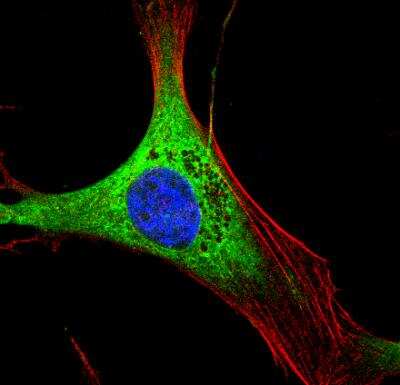 Immunocytochemistry/ Immunofluorescence: Calreticulin Antibody [NB600-103]