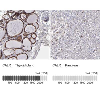 Immunohistochemistry-Paraffin: Calreticulin Antibody [NBP2-48491]