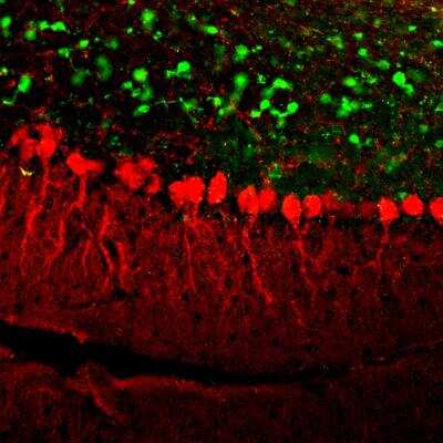 Immunohistochemistry Free-Floating: Calretinin Antibody (3G9) [NBP2-50042]