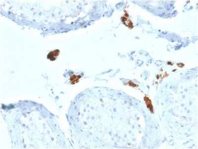 Immunohistochemistry-Paraffin: Calretinin Antibody (CALB2/2602) [NBP3-07365]