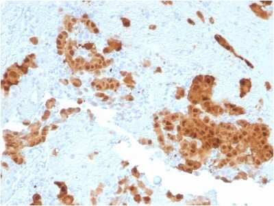 Immunohistochemistry-Paraffin: Calretinin Antibody (CALB2/2602) - Azide and BSA Free [NBP3-08323]