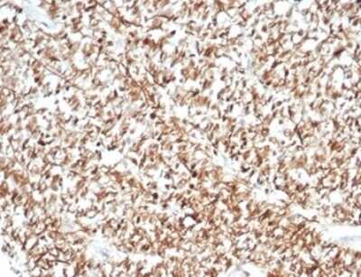 Immunohistochemistry-Paraffin: Calretinin Antibody (CALB2/7029R) [NBP3-13799]