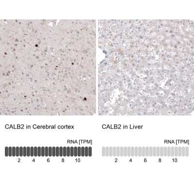 Immunohistochemistry-Paraffin: Calretinin Antibody (CL12836) [NBP3-18575]