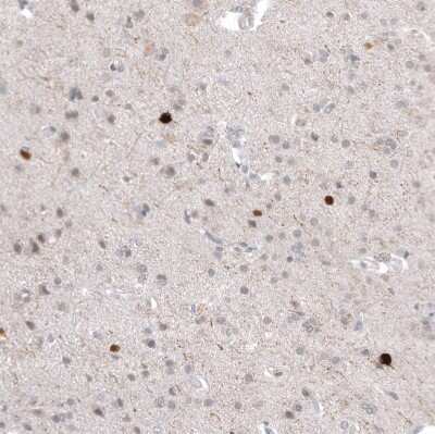 Immunohistochemistry-Paraffin: Calretinin Antibody (CL12836) [NBP3-18575]