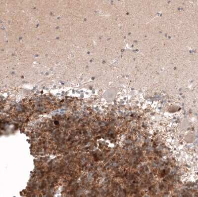Immunohistochemistry-Paraffin: Calretinin Antibody (CL12836) [NBP3-18575]