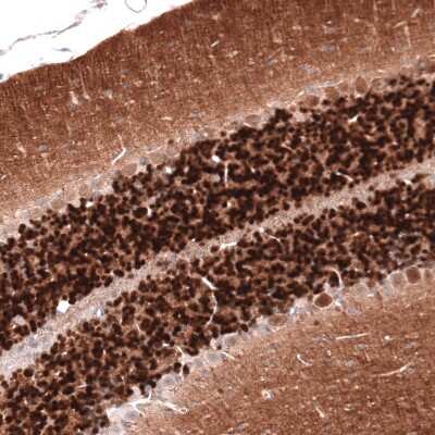 Immunohistochemistry-Paraffin: Calretinin Antibody (CL12836) [NBP3-18575]