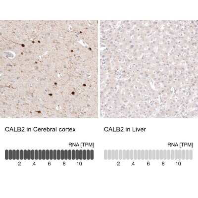Immunohistochemistry-Paraffin: Calretinin Antibody (CL12838) [NBP3-18561]