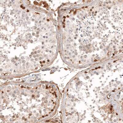Immunohistochemistry-Paraffin: Calretinin Antibody (CL12838) [NBP3-18561]