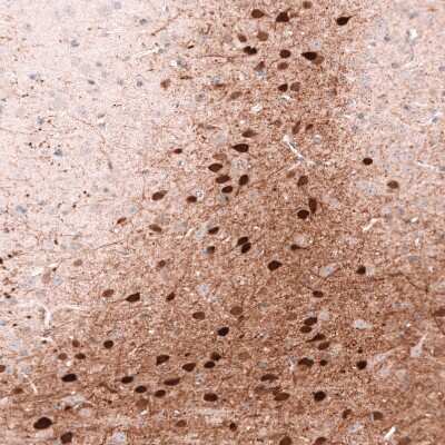 Immunohistochemistry-Paraffin: Calretinin Antibody (CL12838) [NBP3-18561]