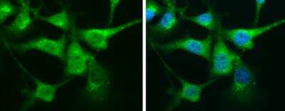 Immunocytochemistry/ Immunofluorescence: Calretinin Antibody [NBP1-32244]