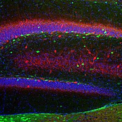 Immunocytochemistry/ Immunofluorescence: Calretinin Antibody [NBP3-05530]