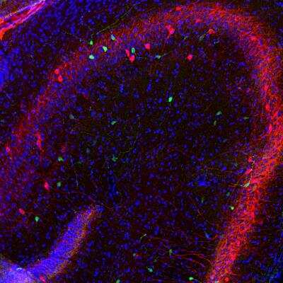 Immunohistochemistry Free-Floating: Calretinin Antibody [NBP2-50029]