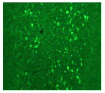 Immunohistochemistry: Calretinin Antibody - Azide and BSA Free [NBP1-30050]