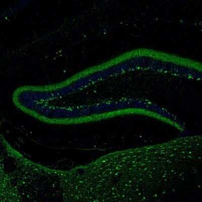 Immunohistochemistry: Calretinin Antibody [NBP1-88221]